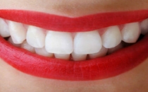 Dişlerinizdeki renk değişimi neyi gösteriyor?